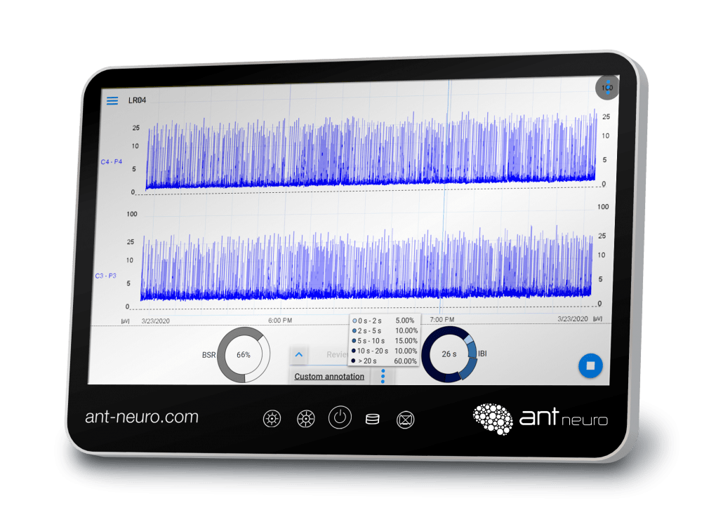 Nëo Infant Brain Monitor (aEEG) - int-bio