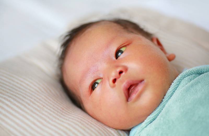 Close up of infant in bed with hyperbilirubinemia (jaundice).