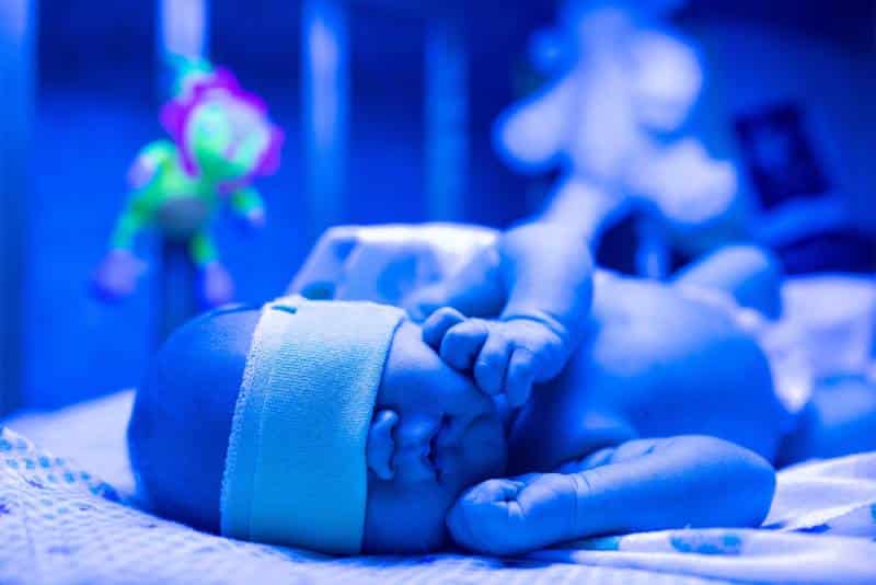 Infant with cloth over their eyes receiving phototherapy for jaundice in NICU.