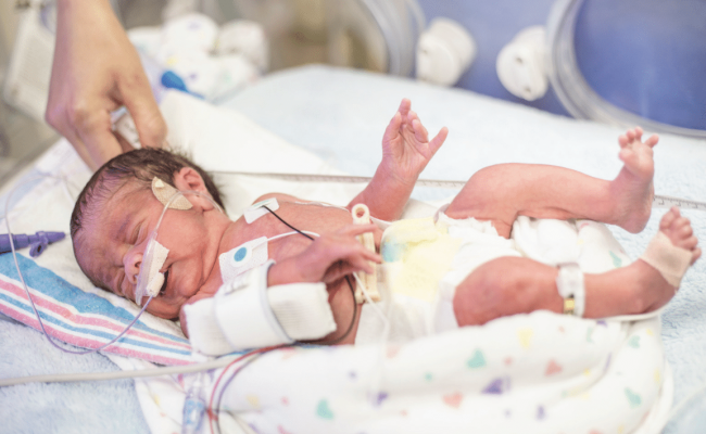 A premature newborn baby lying in a hospital incubator. The baby has dark hair and is being monitored with various medical devices. There are small tubes attached to the baby's nose for oxygen and a few cables connected to sensors on the baby's chest. The baby is wrapped in a soft blanket with a colorful pattern, and a hand is gently supporting one of the hands. The background shows parts of the incubator and other medical equipment.